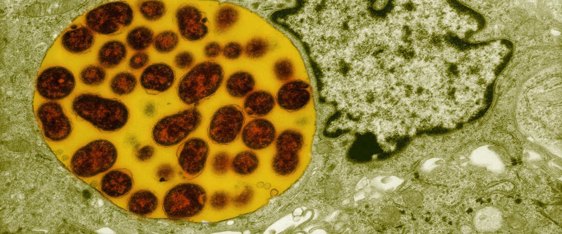 What is the most common std test?